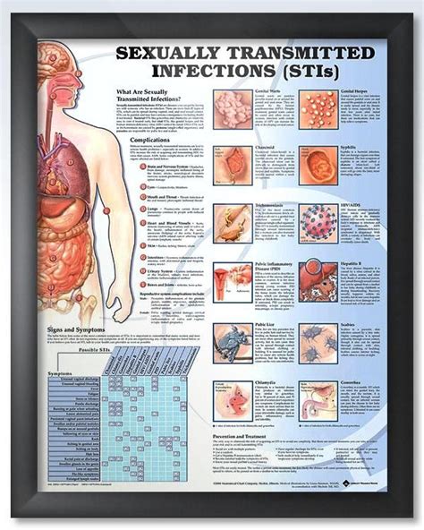 Sexually Transmitted Infections 20x26 Anatomy Poster Medical
