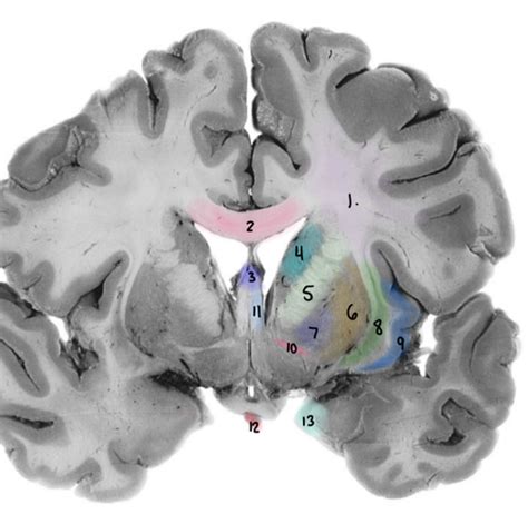 Coronal Section Through The Column Of The Fornix And The Anterior