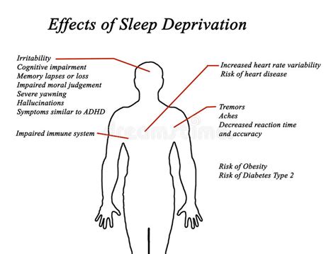 Effects Of Sleep Deprivation Stock Illustration Illustration Of Rate