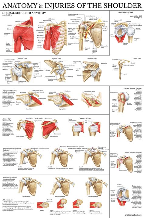 Pack Anatomy And Injuries Of The Knee Shoulder Poster Set