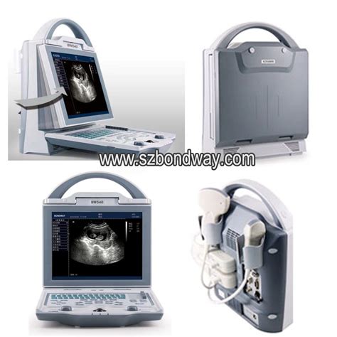 Portable 4d Ultrasound Scanner 4d Fetus Ultrasound Scanning Pregnancy