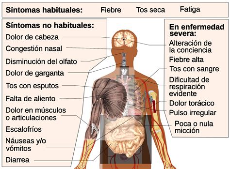 Sanidad investiga tres casos de trombosis en personas vacunadas con astrazeneca | brasil registra más de 2.300 muertos en un día, la cifra más alta gratuito, bilingüe y con un código de barras: Rithka: Gripe Aviar Sintomas En Personas