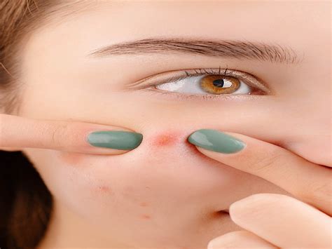 Blind Pimples Painful Bumps That Can Be Felt But Not Easily Seen