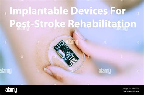 Implantable Devices For Post Stroke Rehabilitation Devices That