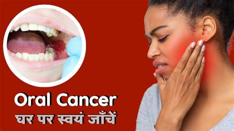 oral cancer self examination मुंह के कैंसर को घर पर स्वयं जांचे youtube