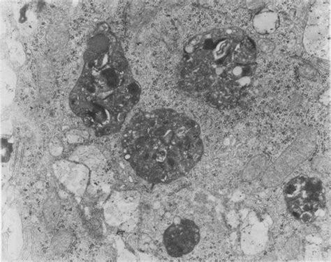 Electron Micrograph Showing The Supranuclear Cytoplasm Of An Absorptive