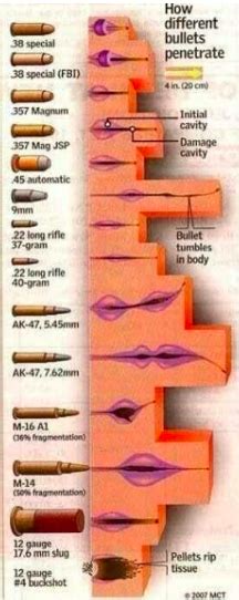 Wounds By Firearms 2 Bullet Caliber And Wound Pics Fightwrite