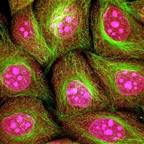 Hela Cells Light Micrograph Stock Image G4420261 Science Photo