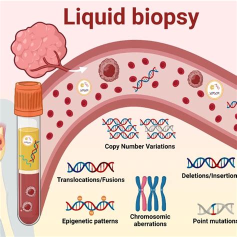 Pdf Clinical Utility Of Liquid Biopsy Based Actionable Mutations