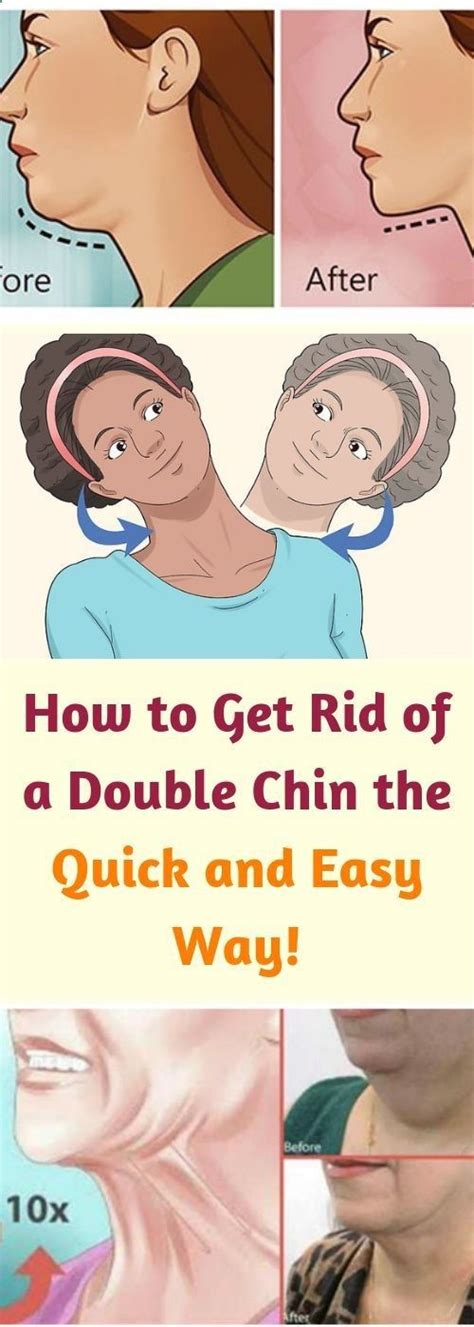 How To Get Rid Of A Double Chin The Quick And Easy Way In 2020 Double