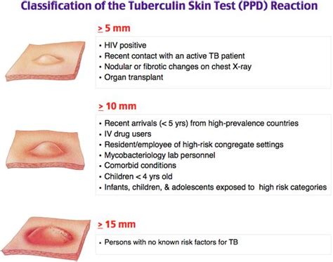Study Medical Photos Interpretation Of Ppd Skin Testing