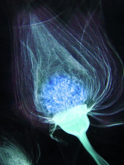 X Ray Of A Flower Colorized Photograph By Allen Penton Pixels