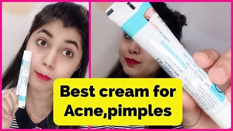 Best Cream For Acne Pimplessuhanistyletips Youtube
