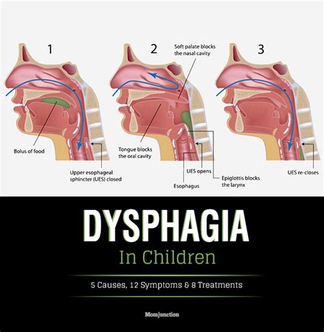 Dysphagia In Children Causes Symptoms And Treatment