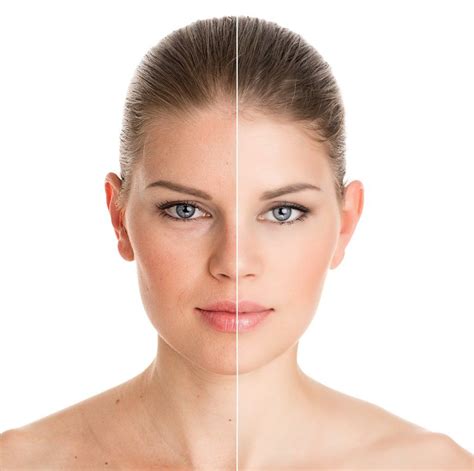 Uneven Skin Tone Managing Uneven Skin Tone On Face Colorescience