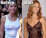 paulina gretzky before and after | Jessica Biel Before & After Breast ...
