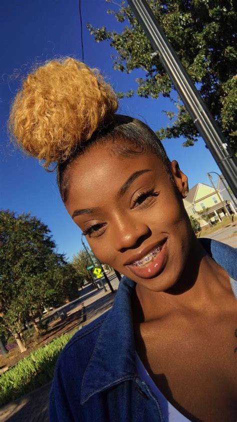 Pin By 💎sydneedior💚 On Braceface Girl With Braces Cute Braces