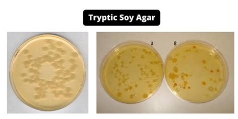 Tryptic Soy Agar Tsa Composition Principle Preparation Results Uses