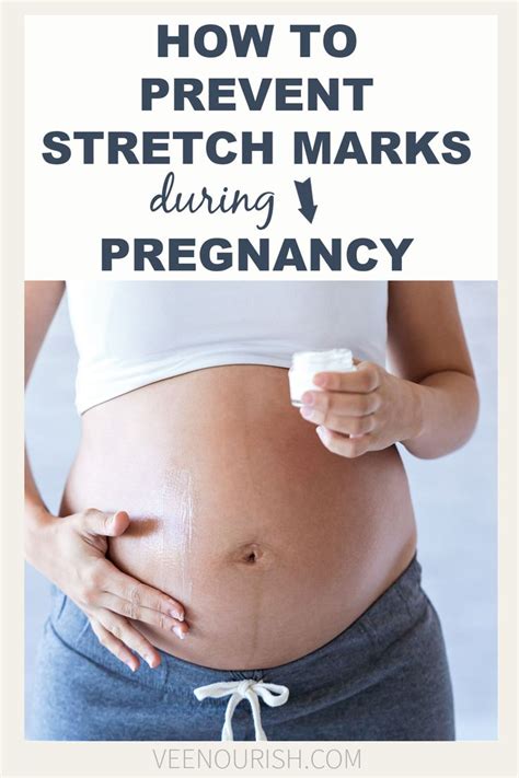 Pin On Stretch Marks Pregnancy