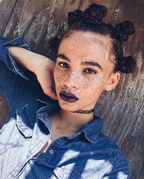 Freckled People Who Ll Hypnotize You With Their Unique Beauty