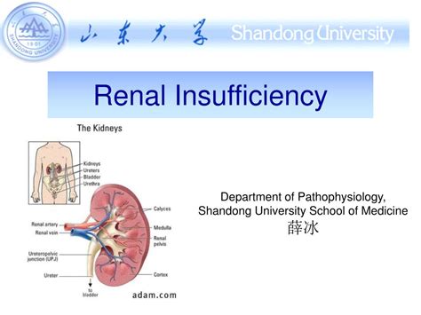 Ppt Renal Insufficiency Powerpoint Presentation Free Download Id