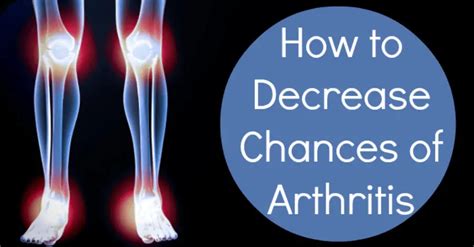 How To Reduce The Risk Of Arthritis Healthpositiveinfo