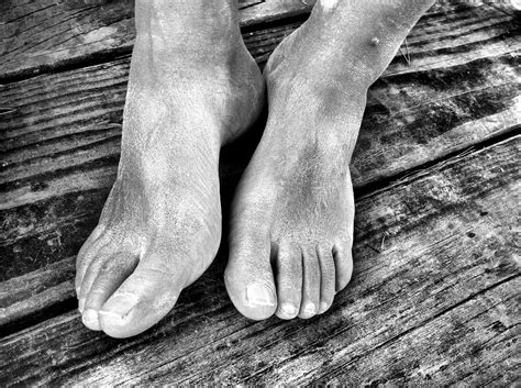 Causes Of Dry Feet