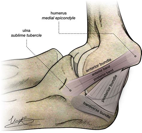 The Pathoanatomy Of The Anterior Bundle Of The Medial Ulnar Collateral