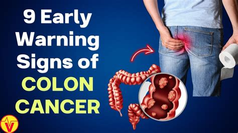 Signs And Symptoms Of Colon Cancer Colorectal Cancer Warning Signs