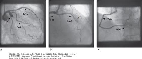 19 Cardiac Catheterization Hospital Handbook