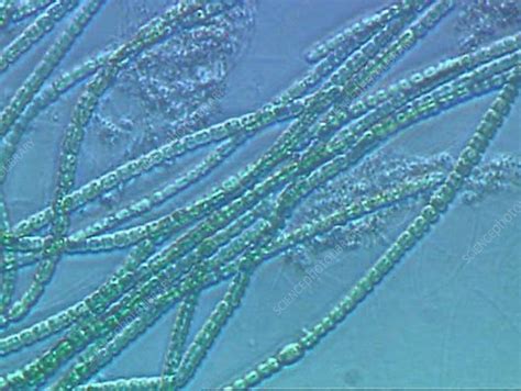Anabaena Algae Stock Video Clip K0021563 Science Photo Library