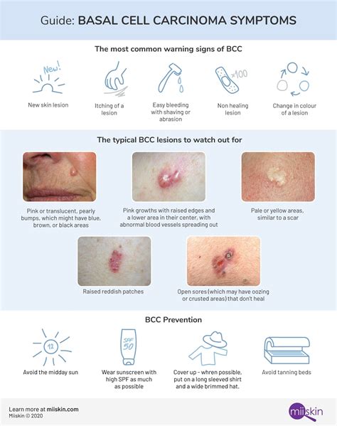 Skin Cancer On Face Early Signs