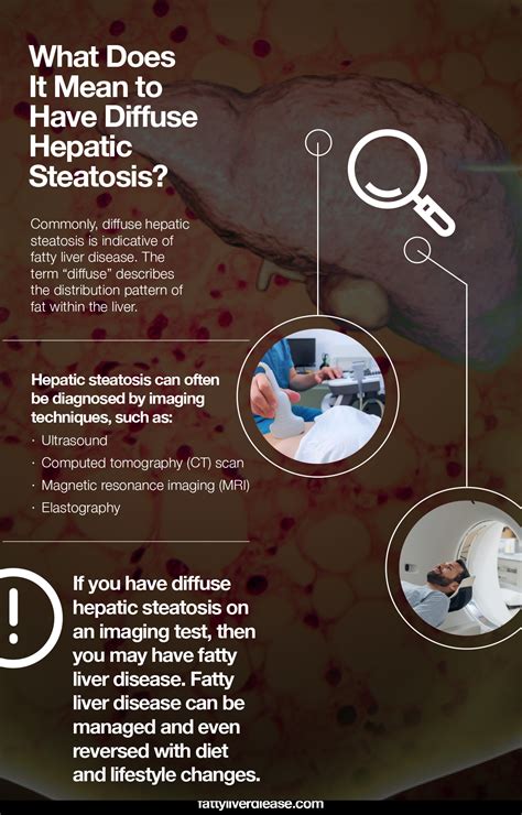 What Is Diffuse Hepatic Steatosis Fatty Liver Disease