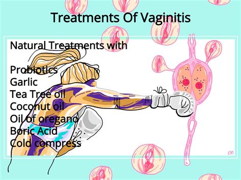 Vaginitis Types Causes Symptoms Diagnosis And Treatment