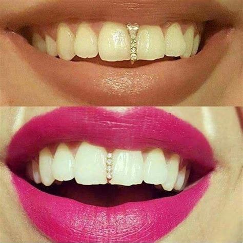 It is important for a patient to discuss all options together with their dentist to ensure the outcome is ideal. Grill To Fix Your Gap Tooth. Yes Or No? - Fashion - Nigeria