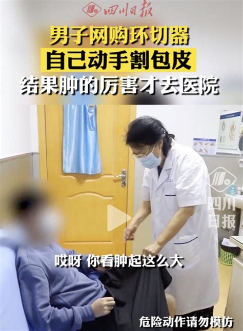 Do It Yourself Circumcisiona Large Number Of Male Patients In China Are Admitted To The