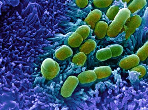 E Coli Bacteria Sem 6 Photograph By Stephanie Schuller Fine Art