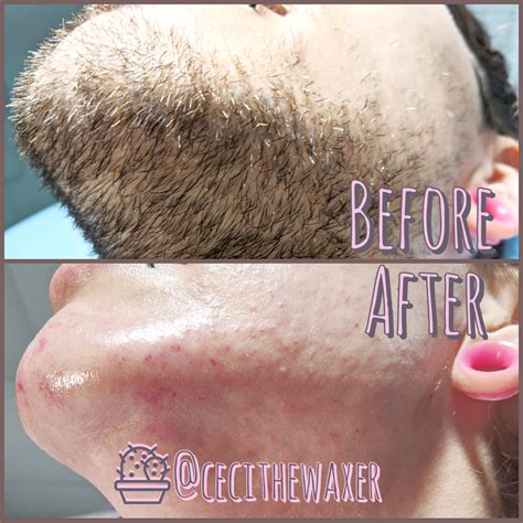 full face waxing before and after face wax full face waxing facial waxing