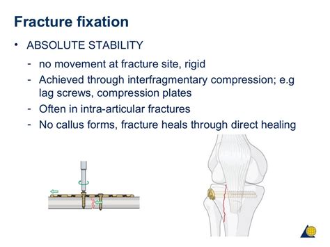 Principles Of Fracture Fixation