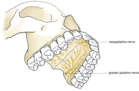 5 Local Anaesthesia In The Upper Jaw Pocket Dentistry