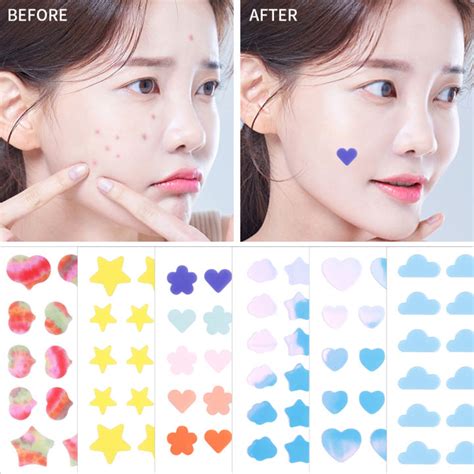 Colorful Pimple Patch Invisible Acne Skin Care Stickers Concealer