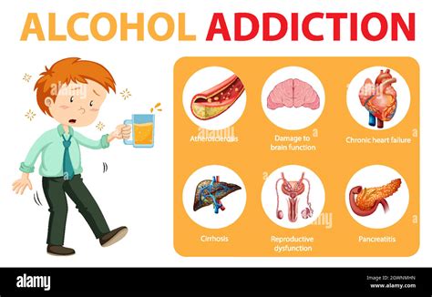 Alcohol Addiction Or Alcoholism Information Infographic Stock Vector