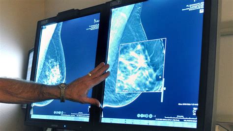 Breast Cancer Surgery Healing Process May Trigger Cancer To Spread