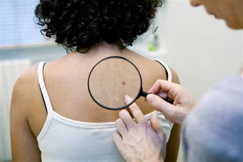 How To Identify Skin Cancer Warning Signs Nd2a Content