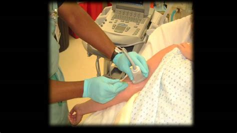 Ultrasound Guided Central Venous Catheterization In The Prone Position My XXX Hot Girl