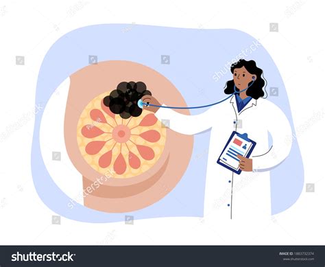Breast Cancer Diagram Images Stock Photos Vectors Shutterstock