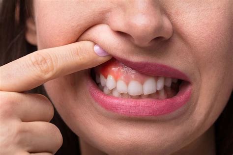 3 Warning Signs Of Gum Disease You Shouldnt Ignore Advanced Care