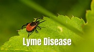 Lyme Disease Symptoms, Causes, Questions Answered - Elitecare Emergency ...