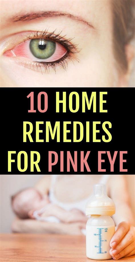 10 Amazing Home Remedies For Pink Eye You Can Trust Pinkeye Remedies