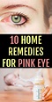 10 Amazing Home Remedies for Pink Eye You Can Trust | Pinkeye remedies ...